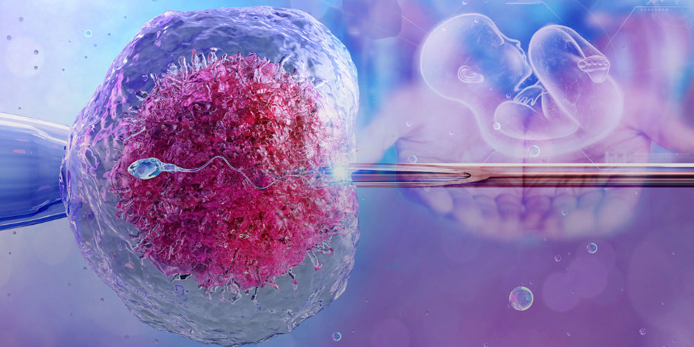 IVF