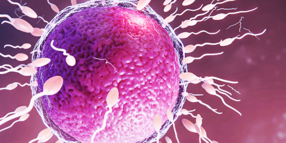 IUI